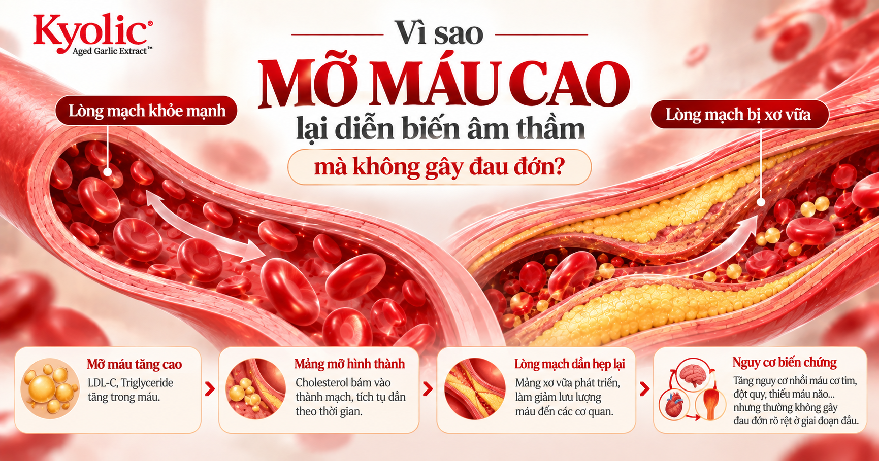 mỡ máu cao